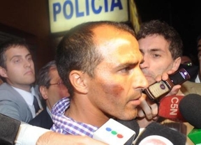 Morel Rodríguez no fue a entrenar por el dolor de los golpes de la policía