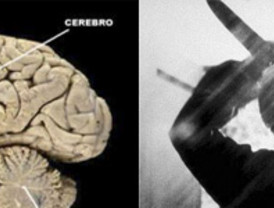 Investigadores cántabros descubren una relación entre partes del sistema nervioso y la psicosis