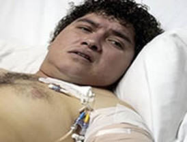 España: Tiran a la basura el brazo de un boliviano que sufrió un accidente