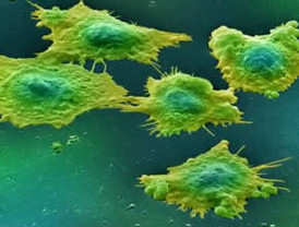 Componentes genéticos pueden frenar el cáncer