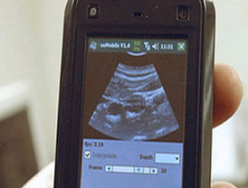 Sistema permitirá hacer ecografías con una USB conectada al móvil