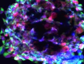 Quedó aprobado el primer estudio con células madre para parapléjicos en Estados Unidos