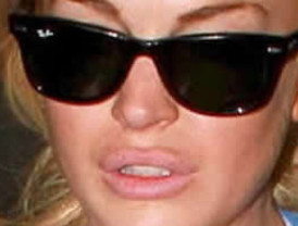Aumenta el tamaño de sus labios Lindsay Lohan