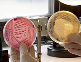 El brote de 'E.coli' de Francia procedía de carne picada de la alemana Lidl