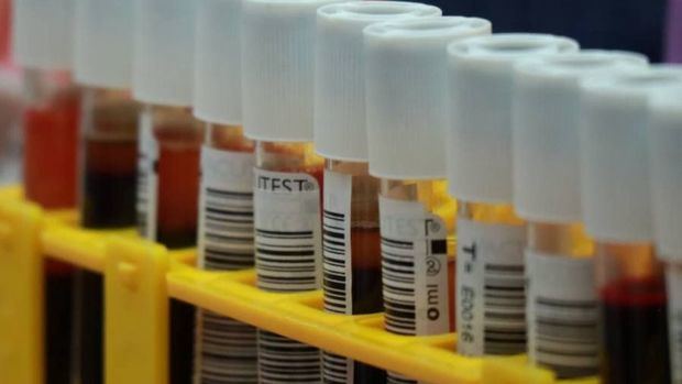 Ante la caída de las donaciones en agosto la Comunidad de Madrid hace un llamamiento a donar sangre