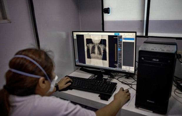 IA mejora detección de tuberculosis en Manila
